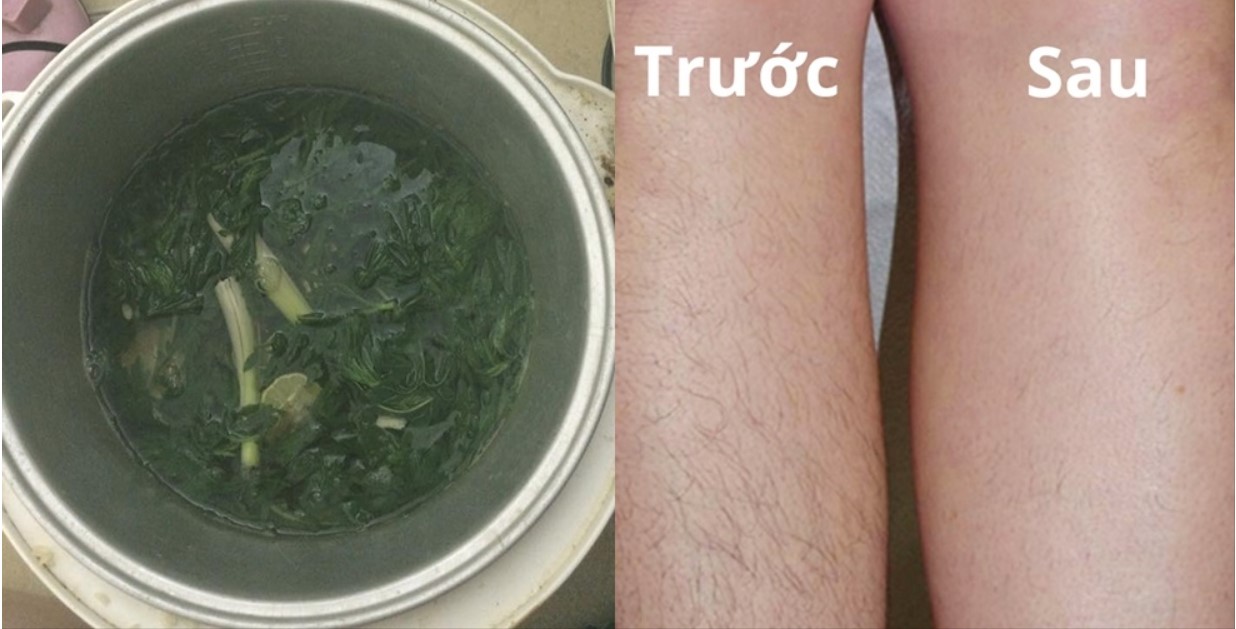 tẩy lông chân bằng ngải cứu, cách tẩy lông chân bằng lá ngải cứu, review tẩy lông chân bằng lá ngải cứu webtretho, tẩy lông chân bằng ngải cứu có hiệu quả không