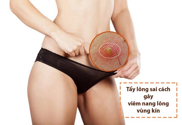 cách tẩy lông vùng kín bằng mật ong, các bước tẩy lông vùng kín, tẩy lông vùng kín bị rát, tẩy lông vùng kín tại nhà