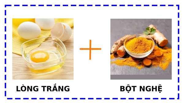 cách trị thâm nách