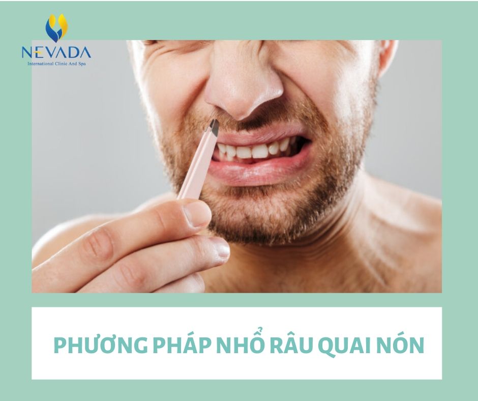 triệt râu quai nón tại nhà, tẩy râu quai nón tại nhà, cách triệt râu quai nón tại nhà, cách tẩy râu quai nón tại nhà, cách triệt râu quai nón vĩnh viễn tại nhà