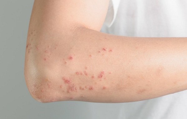 kem tẩy lông thái dương, kem tẩy lông lưu ly có tốt không, kem tẩy lông lưu ly, kem tẩy lông lưu ly của mỹ phẩm thái dương, tác hại của kem tẩy lông lưu ly, kem tẩy lông lưu ly thái dương, kem tẩy lông lưu ly của thái dương, kem tẩy lông lưu ly dùng tốt không, kem tẩy lông liuly