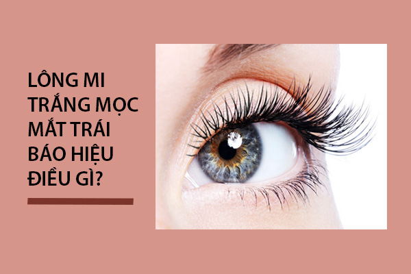 sợi lông mi bạc, lông mi bạc, lông mi màu trắng, mọc lông mi màu trắng, lông mi trắng, lông mi mọc dài bất thường, lông mi dài bất thường, lông mi dài nói lên điều gì, hiện tượng lông mi bạc, ý nghĩa của lông mi bạc, lông mi bị bạc, tại sao lông mi bị bạc, lông mi mắt bị bạc, lông mi có sợi bạc, lông mi dài bạc, lông mi bạc có ý nghĩa gì, lông mi bạc phải làm sao, bệnh lông mi trắng, lông mi dài trắng, lông mi mắt màu trắng, lông mi chuyển màu trắng, tại sao lại có lông mi trắng