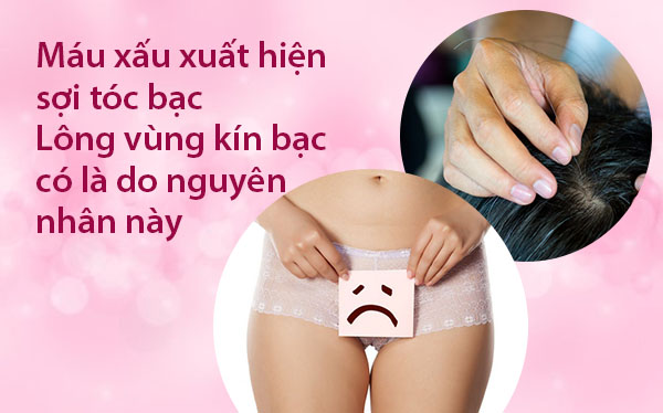 lông vùng kín bị bạc trắng, lông bạc mọc ở vùng kín, lông mu nữ bị bạc, lông mu bị bạc, lông vùng kín bị bạc, lông mu màu trắng, lông mu bạc, lông mu bạc màu