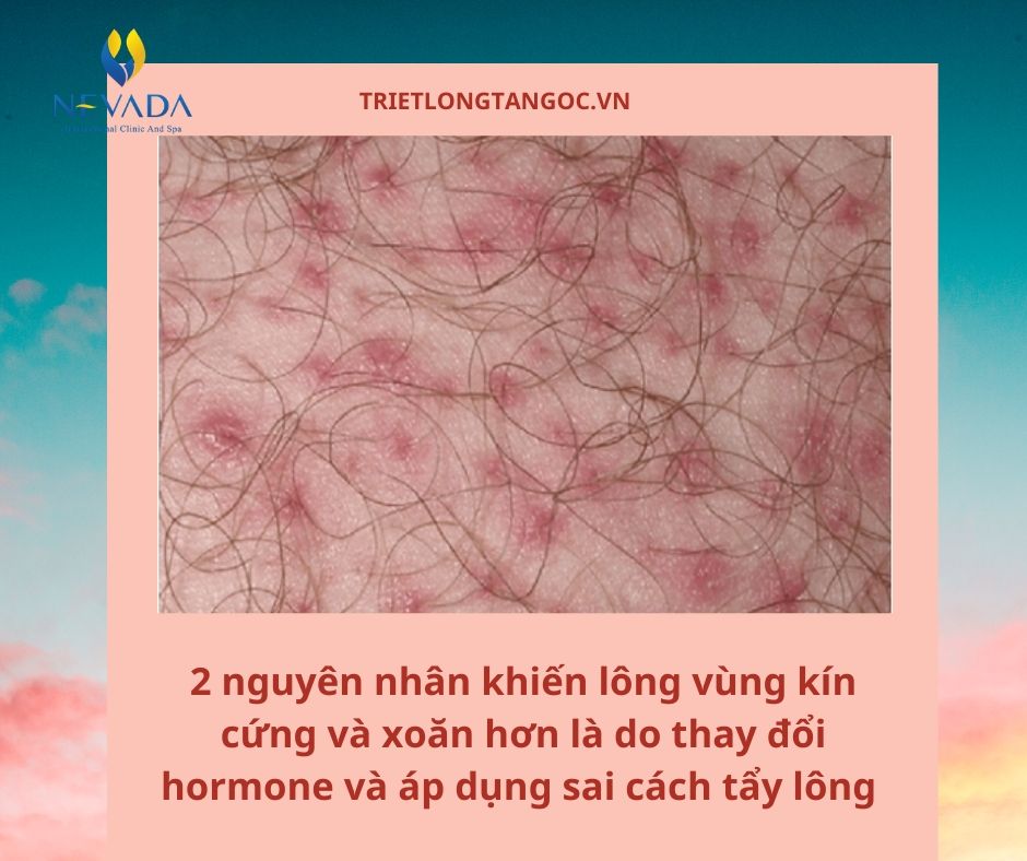 phương pháp làm mềm lông vùng kín, làm mềm lông vùng kín, lông vùng kín cứng, lông mu cứng, lông vùng kín khô cứng, lông mu rậm phải làm sao, lông mu cứng và đau, long mu ram, lông mu khô cứng, cách làm mềm lông mu sau khi cạo, lông mu dày và cứng, đau lông mu, lông mu cứng gây ngứa, cách làm mềm lông vùng kín sau khi cạo, cách làm mềm lông mu, làm mềm lông mu, làm sao để lông mu mềm, cách làm mềm lông vùng kín, tại sao lông mu lại cứng, cách tỉa lông mu ở nữ, long mu, lông mu của phụ nữ, lông vùng kín nhiều phải làm sao, long lon ram, lông mu nữ rậm cứng, rậm lông mu, làm sao để lông vùng kín mềm mại, lông mu dày, vùng kín nhiều lông phải làm sao, tẩy lông mu phụ nữ, lông mu, cách làm mềm mượt lông vùng kín, cách làm lông mềm, triệt lông bị ngứa, đau vùng lông mu, tại sao bị ngứa vùng kín, ngứa vùng kín nam, mu nu, ngứa cơ quan sinh dục, vùng kín có mùi hôi nhưng không ngứa, vùng kín có mùi, longmu, ngứa vùng kín ở nữ, chức năng của lông mu, mu long, lông mu ở phụ nữ, các kiểu lông mu phụ nữ, mu ram, triệt lông mu vĩnh viễn, lông mu rậm, mu to long ram, triệt lông vùng kín nữ, tẩy lông mu, ngứa vùng kín ở nam giới, triệt lông mu, vùng kín rậm rạp phải làm sao, ngứa vùng lông mu, mu nữ, tia long mu, tẩy lông mu vùng kín, hiện tượng ngứa tay chân, tay long lon, lông mu rậm và cứng, ngứa vùng kín phải làm sao, mu lông, bikini mu to, long mu nu gioi, ngứa lông mu ở nữ, lông mu nhiều phải làm sao, vùng kín bị ngứa, cách triệt lông mu, tại sao lại bị ngứa vùng kín, mềm lông, ngứa vùng lông mu ở nữ, tác dụng của lông mu nữ, lo long mu, ngứa lông mu, ngứa rát vùng kín nam giới, bị ngứa lông mu vùng kín, tẩy lông mu nữ, đau lông vùng kín, bị ngứa vùng kín, triet long mu, tại sao vùng kín bị ngứa, long mu nu, vùng kín bị ngứa rát, tẩy lông vùng kín nữ, các loại lông mu, đau phần lông mu, mulong, lông mu nữ, cách làm lông vùng kín mềm, ngứa bộ phận sinh dục nữ, lông vùng kín quá rậm phải làm sao, ngứa ở vùng kín, cách tỉa lông mu, cách chữa rụng lông mu, mọc lông mu bị ngứa, ngứa âm đạo, lông vùng kín rậm, tẩy lông vùng kín nữ giới, bị ngứa vùng kín ở nữ, ngứa vùng kín nữ giới, ngứa ở vùng kín nam giới, tỉa lông mu, long mu la gi, ngứa vùng kín là bị gì, kem tẩy lông vùng kín nữ giới, tẩy lông vùng kín cho chị em, ngứa bộ phận sinh dục nam ve dem, cách làm lông mu mềm, lông mu ngứa, cách mọc lông mu nhanh nhất, ngứa vùng kín nữ, lông vùng kín phụ nữ, vùng kín, triệt lông mu nam giới