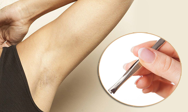 nhổ lông nách có hại gì, nhổ lông nách có hại không, tác hại nhổ lông nách, có nên dùng nhíp nhổ lông nách, nhổ lông nách bằng nhíp có tác hại gì, Có nên nhổ lông nách bằng nhíp không,Nhổ lông nách bằng nhíp có tốt không, nhổ lông nách bằng nhíp đúng cách, nhổ lông nách có bằng nhíp có hại không, tác hại của việc nhổ lông nách bằng nhíp, nhổ lông nách bằng nhíp, nhổ lông nách tại nhà, triệt lông nách tại nhà, triệt lông nách tận gốc, triệt lông nách an toàn, triệt lông nách vĩnh viễn, cách triệt lông nách tại nhà