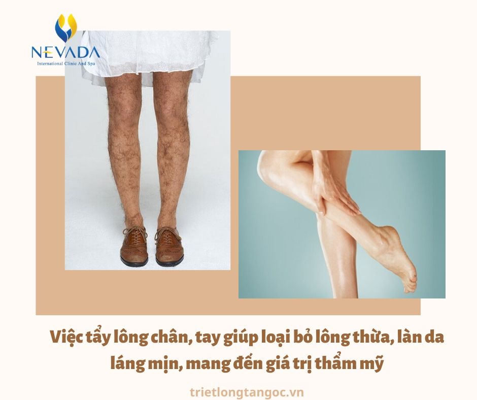 có nên đi triệt lông tay chân vĩnh viễn không, Review triệt lông vĩnh viễn, có nên triệt lông vĩnh viễn không, có nên tẩy lông vĩnh viễn không, có nên triệt lông vĩnh viễn ko, có nên triệt lông chân vĩnh viễn không, có nên đi triệt lông vĩnh viễn không, có nên triệt lông mép vĩnh viễn không, có nên triệt lông vĩnh viễn hay không, có nên tẩy lông chân, tẩy lông chân có ảnh hưởng gì không, tẩy lông có ảnh hưởng gì không, triệt lông chân có ảnh hưởng gì không, tẩy lông chân nhiều có tốt không, tẩy lông chân có hại không, có nên tẩy lông tay chân không, có nên tẩy lông tay không, có nên triệt lông tay không, có nên triệt lông chân, tẩy lông tay chân có tốt không, có nên triệt lông chân không, có nên tẩy lông chân không, có nên tẩy lông chân hay không, có nên tẩy lông không, triệt lông tay chân có ảnh hưởng gì không, tẩy lông có tốt không, có nên tẩy lông, tẩy lông tay có sao không, triệt lông có tốt không, triệt lông chân có hại không, triệt lông vĩnh viễn có ảnh hưởng gì không, triệt lông có ảnh hưởng gì không, tẩy lông chân có tốt không