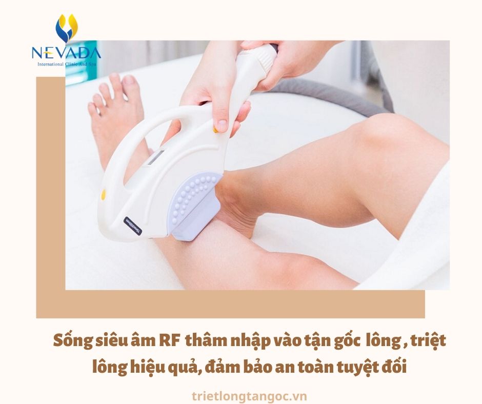 có nên đi triệt lông tay chân vĩnh viễn không, Review triệt lông vĩnh viễn, có nên triệt lông vĩnh viễn không, có nên tẩy lông vĩnh viễn không, có nên triệt lông vĩnh viễn ko, có nên triệt lông chân vĩnh viễn không, có nên đi triệt lông vĩnh viễn không, có nên triệt lông mép vĩnh viễn không, có nên triệt lông vĩnh viễn hay không, có nên tẩy lông chân, tẩy lông chân có ảnh hưởng gì không, tẩy lông có ảnh hưởng gì không, triệt lông chân có ảnh hưởng gì không, tẩy lông chân nhiều có tốt không, tẩy lông chân có hại không, có nên tẩy lông tay chân không, có nên tẩy lông tay không, có nên triệt lông tay không, có nên triệt lông chân, tẩy lông tay chân có tốt không, có nên triệt lông chân không, có nên tẩy lông chân không, có nên tẩy lông chân hay không, có nên tẩy lông không, triệt lông tay chân có ảnh hưởng gì không, tẩy lông có tốt không, có nên tẩy lông, tẩy lông tay có sao không, triệt lông có tốt không, triệt lông chân có hại không, triệt lông vĩnh viễn có ảnh hưởng gì không, triệt lông có ảnh hưởng gì không, tẩy lông chân có tốt không