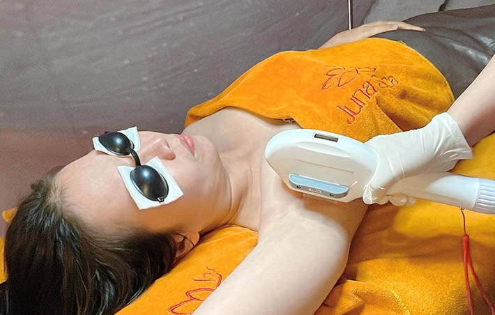 triệt lông tại Juna Spa