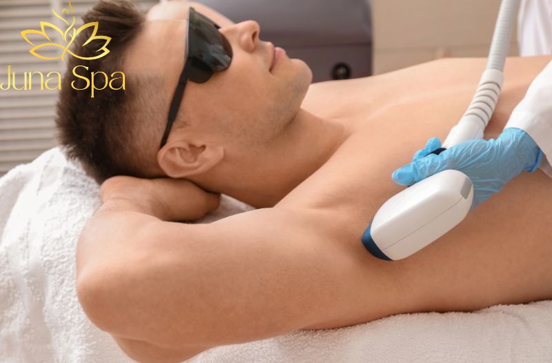 Triệt lông nam giới