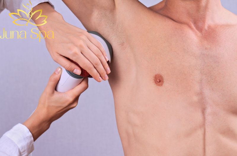 Vì sao nam giới ngày càng quan tâm đến triệt lông